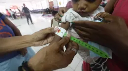 2021年4月东帝汶发生洪灾后，首都帝力的儿童在接受营养不良筛查。