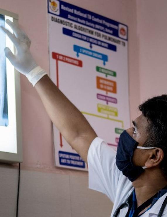 Мужчина в медицинской маске изучает рентгеновский снимок груди