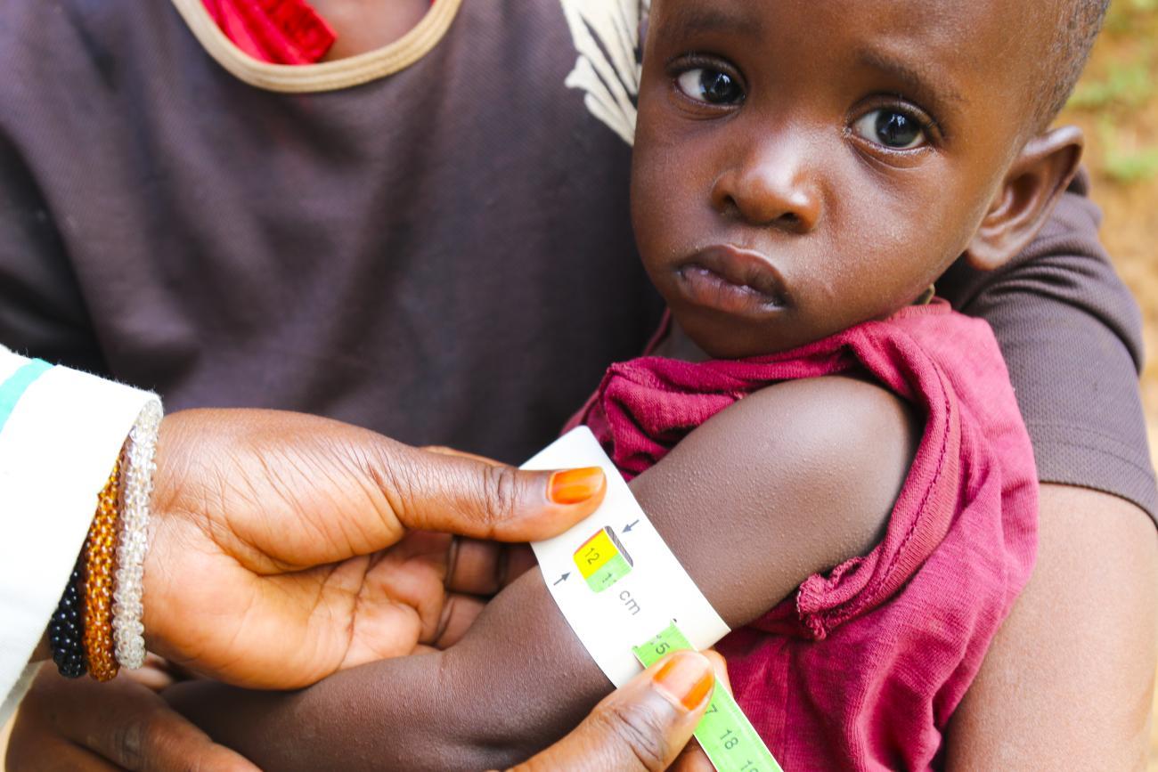 A baby is being held with a mid-upper arm circumference to help determine malnutrition.