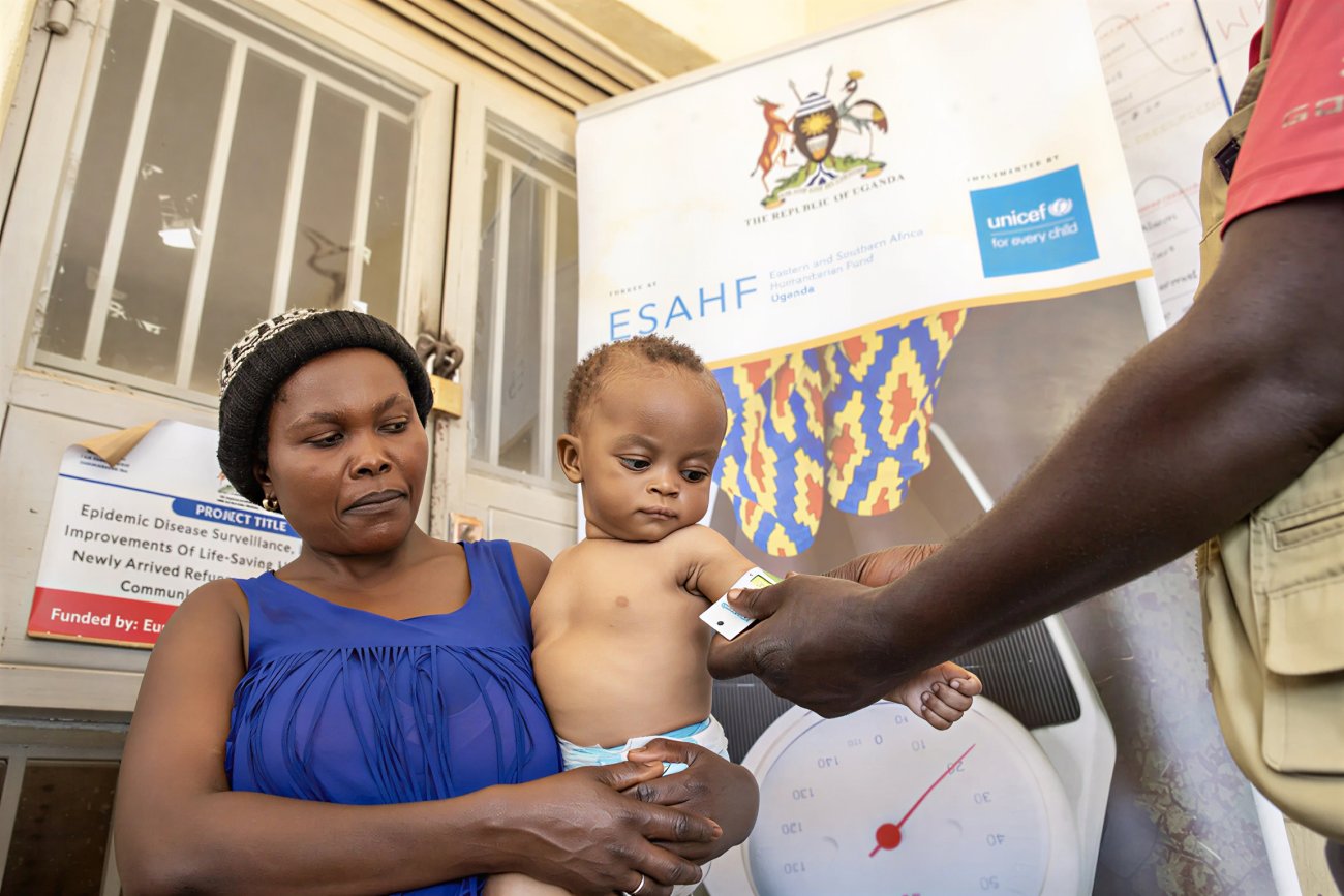 A child in Uganda receives malnutrition support.