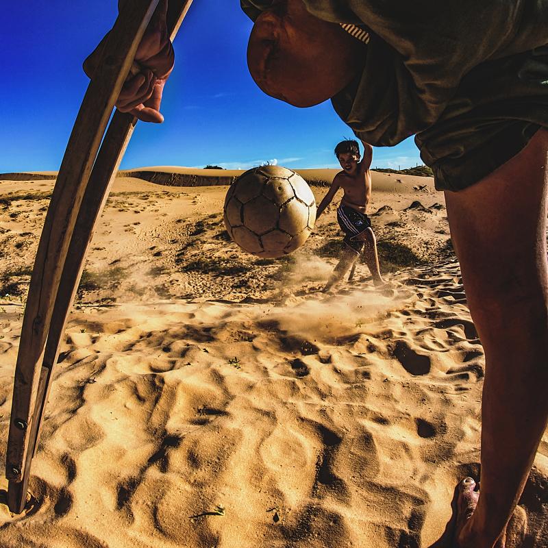 تُظهر الصورة لقطة مقرّبة بين ساقي رجل مبتور الساق. من خلال هذه الزاوية، يمكنك رؤية كرة قدم يركلها صبي صغير.